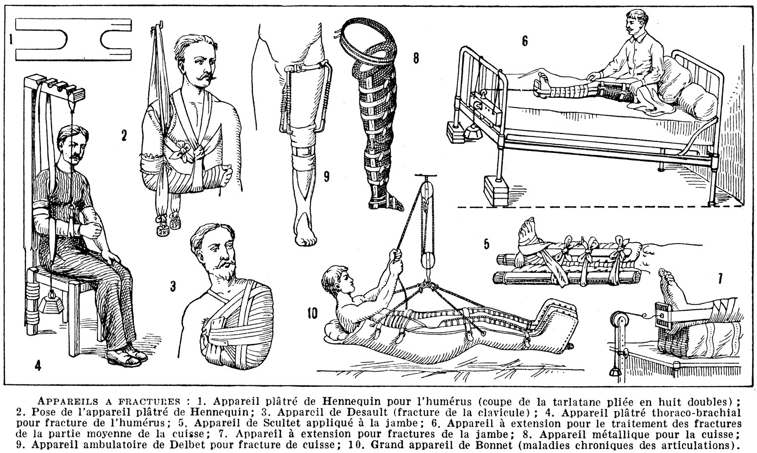 Schwarz-weiß-Zeichnung eines Mannes im Krankenhausbett mit einem Gipsverband am Bein, umgeben von Bildern von Menschen, einer sitzenden Person und verschiedenen Gegenständen, mit dem Text "Knochenbrüche von Arm und Bein" unten.
