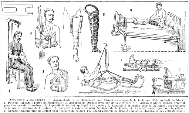 Schwarz-weiß-Zeichnung eines Mannes im Krankenhausbett mit einem Gipsverband am Bein, umgeben von Bildern von Menschen, einer sitzenden Person und verschiedenen Gegenständen, mit dem Text "Knochenbrüche von Arm und Bein" unten.
